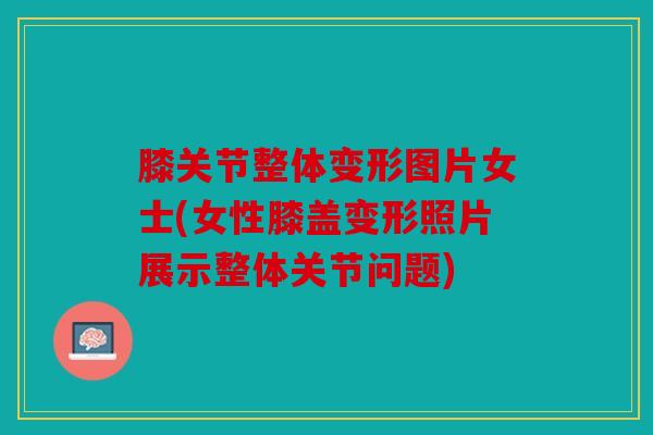 膝关节整体变形图片女士(女性膝盖变形照片展示整体关节问题)