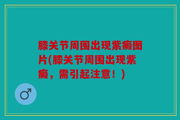 膝关节周围出现紫癜图片(膝关节周围出现紫癜，需引起注意！)
