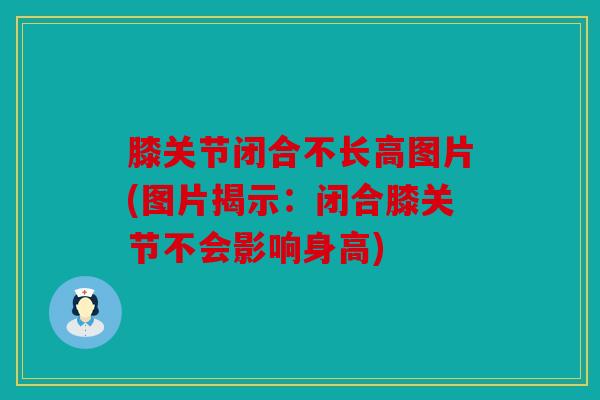 膝关节闭合不长高图片(图片揭示：闭合膝关节不会影响身高)