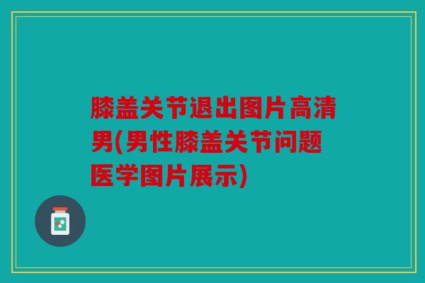 膝盖关节退出图片高清男(男性膝盖关节问题医学图片展示)