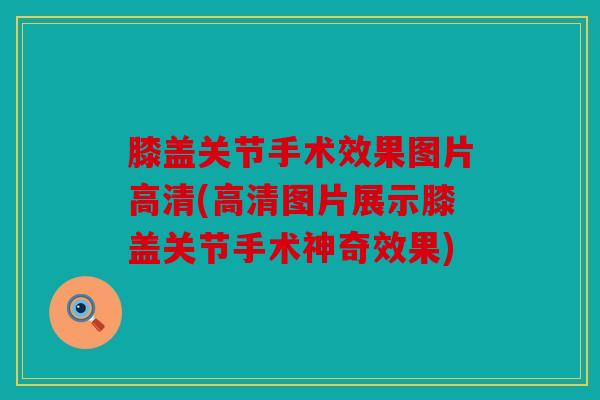 膝盖关节手术效果图片高清(高清图片展示膝盖关节手术神奇效果)