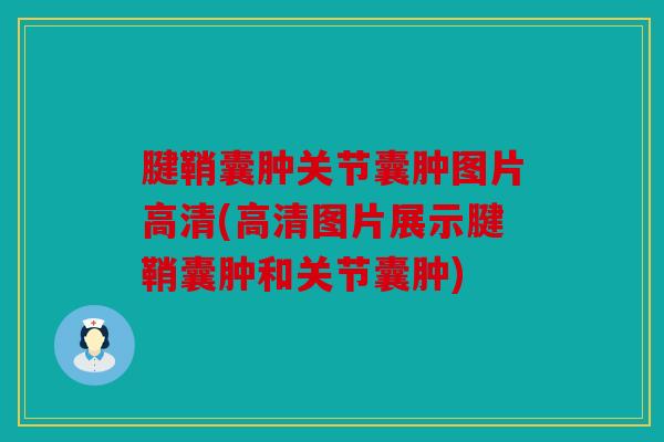 腱鞘囊肿关节囊肿图片高清(高清图片展示腱鞘囊肿和关节囊肿)