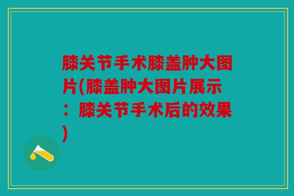 膝关节手术膝盖肿大图片(膝盖肿大图片展示：膝关节手术后的效果)