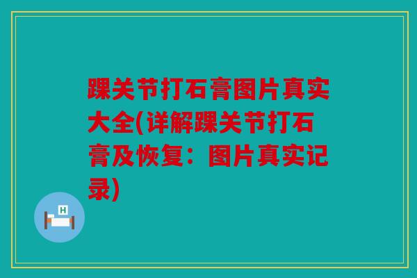 踝关节打石膏图片真实大全(详解踝关节打石膏及恢复:图片真实记录) 踝关节打石膏图片真实大全(详解踝关节打石膏及恢复:图片真实记录)